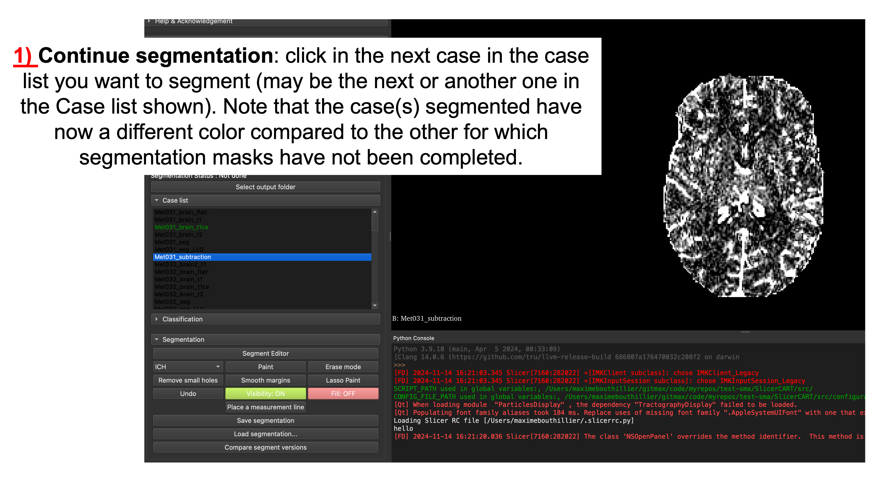 _images/continue_segmentation.png