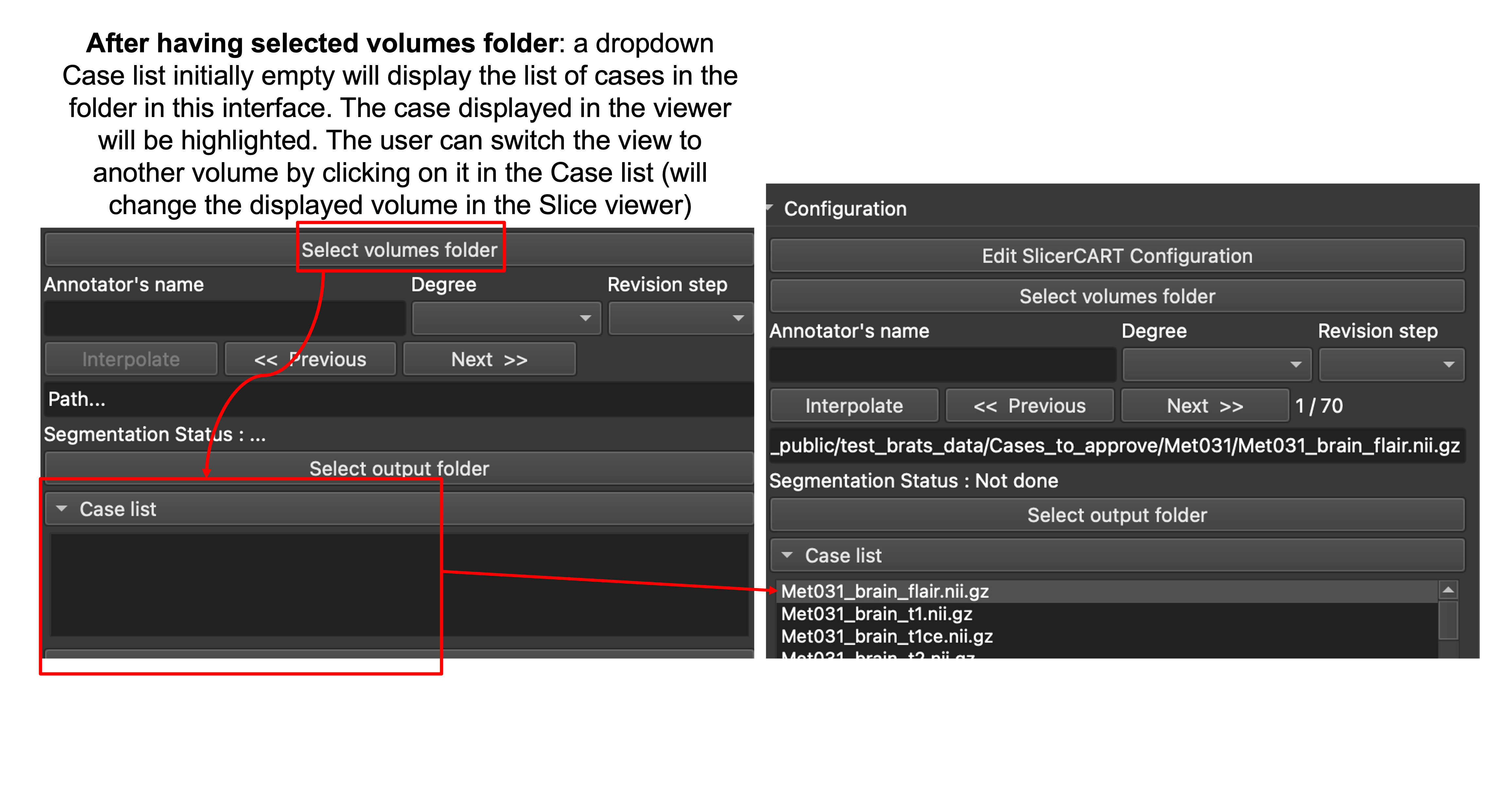 _images/example_loading_cases_ui.png