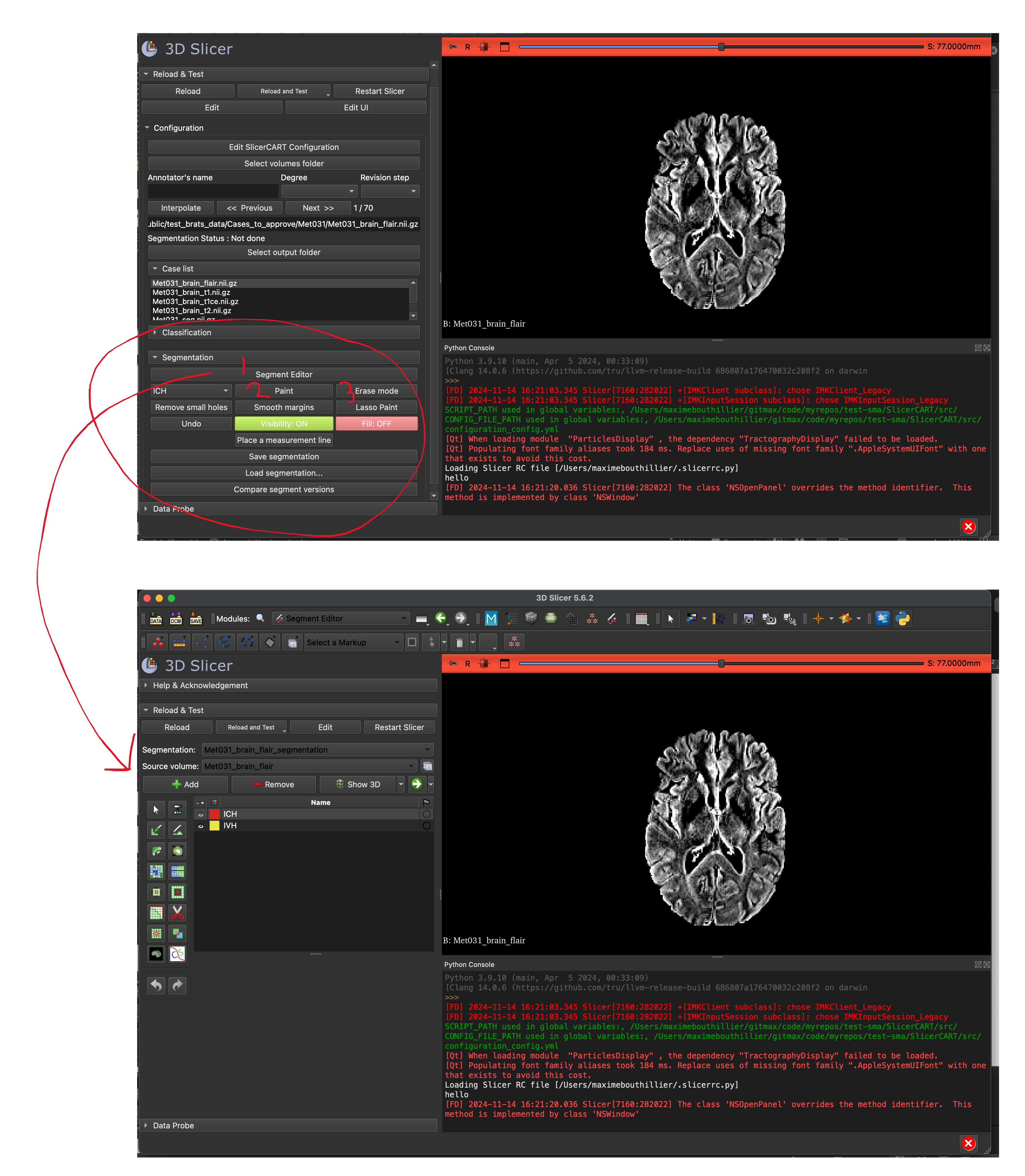 _images/perform_segmentation.png