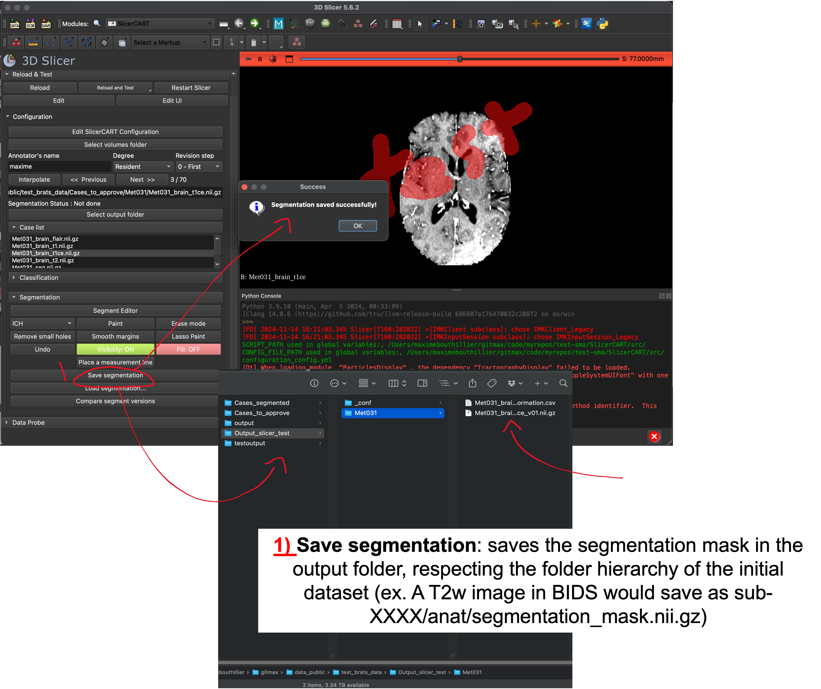 _images/save_segmentation.png