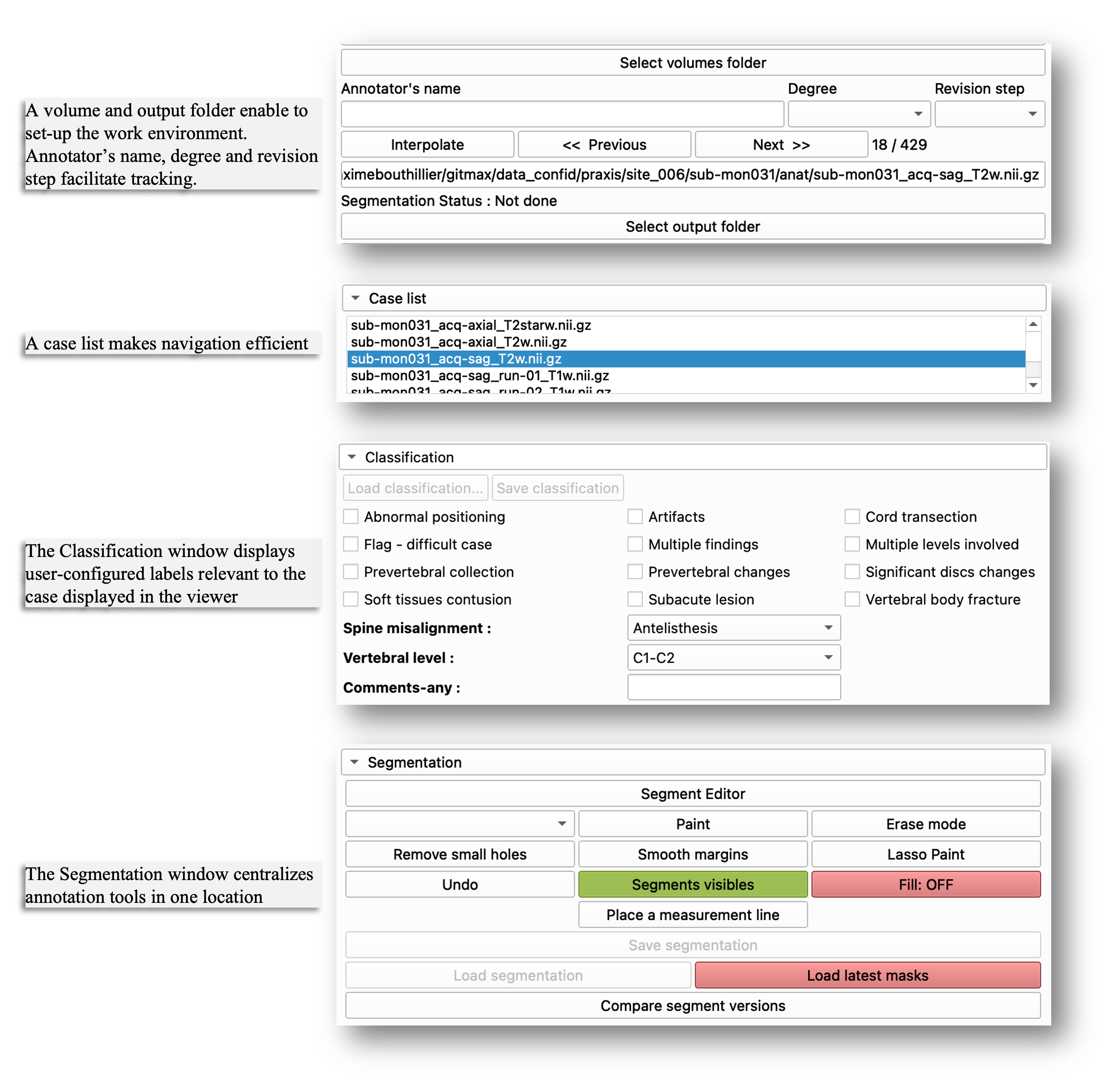 User Interface